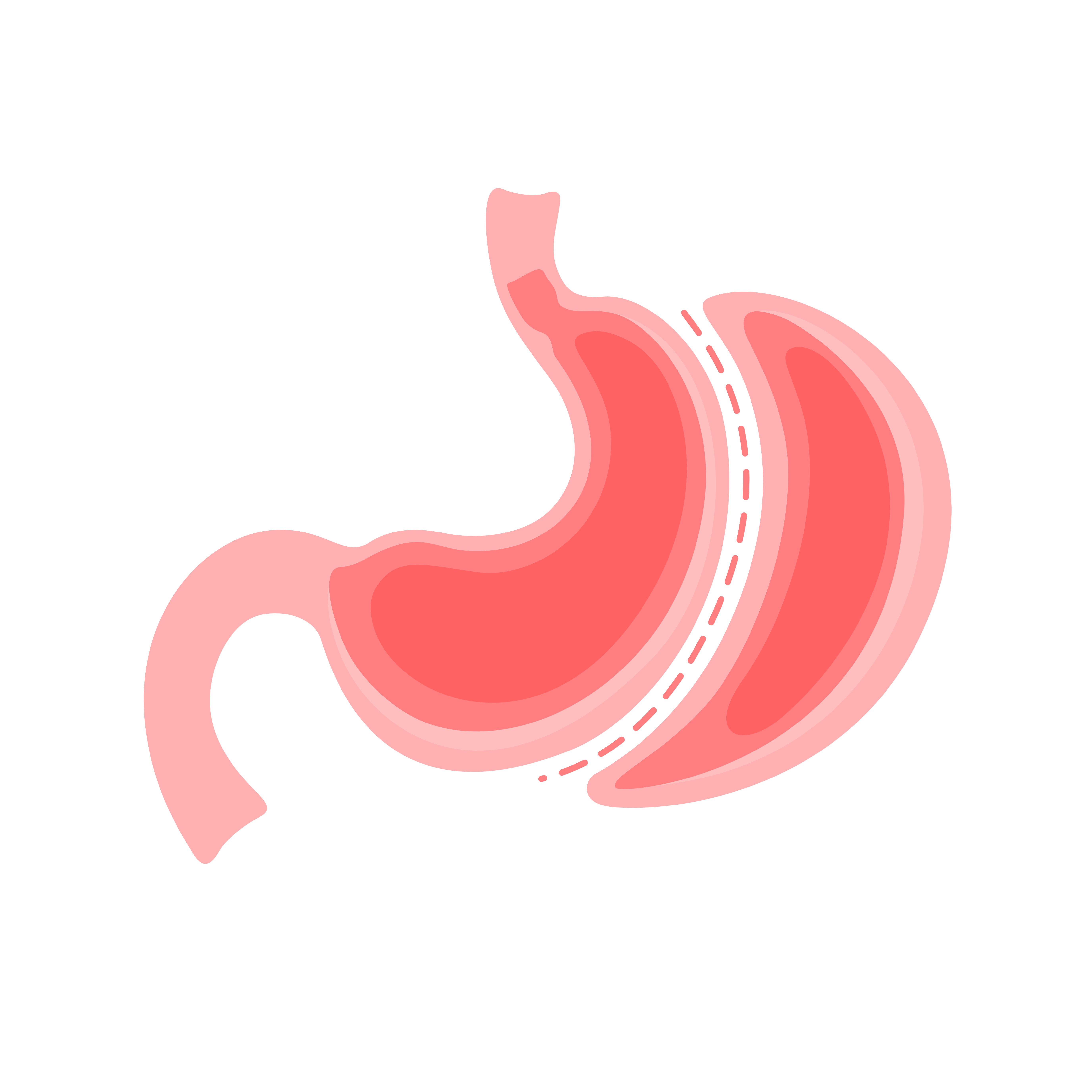 Bariatric Surgery (MIBS)